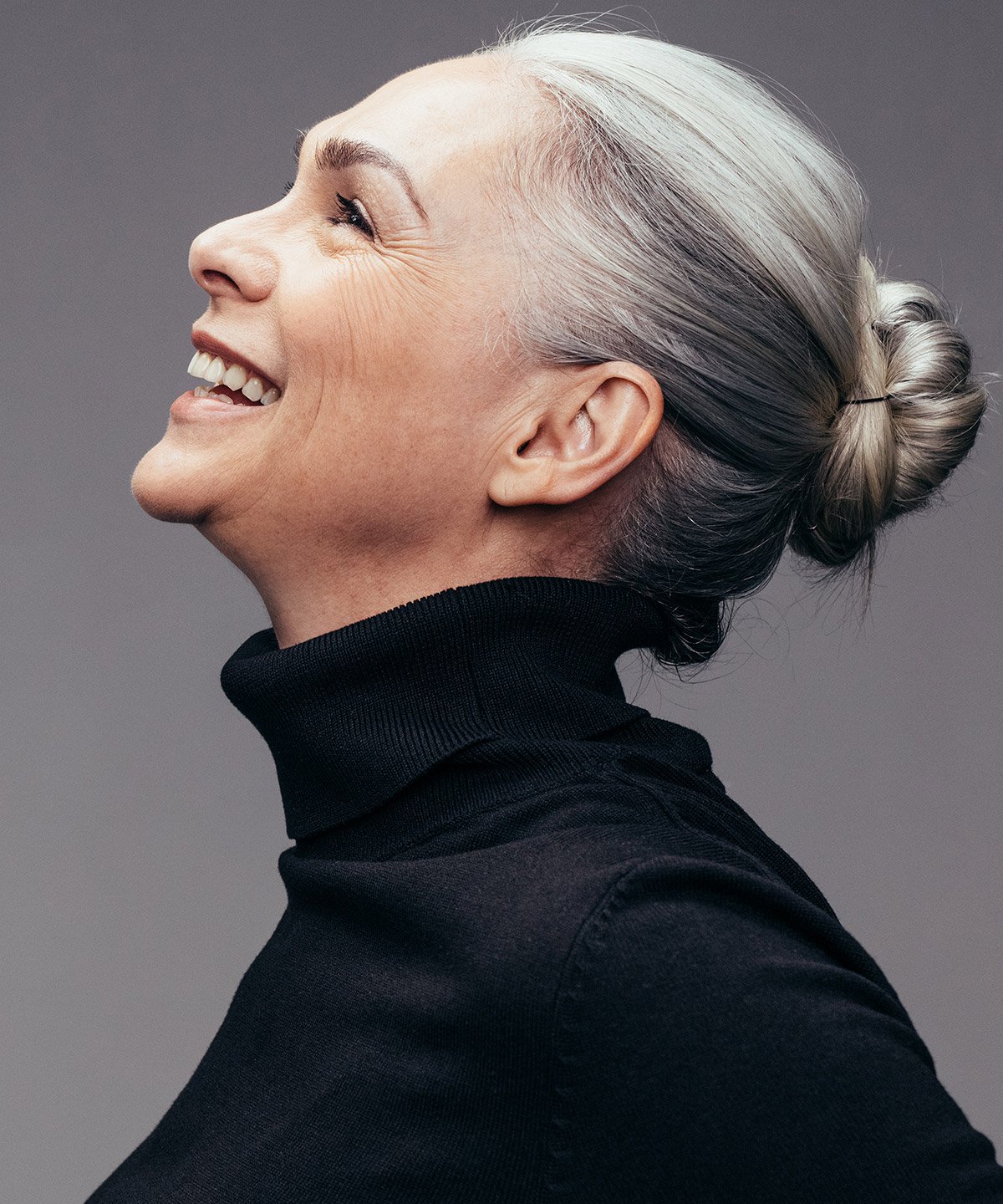 Cheek Lift Surgery West Palm Beach